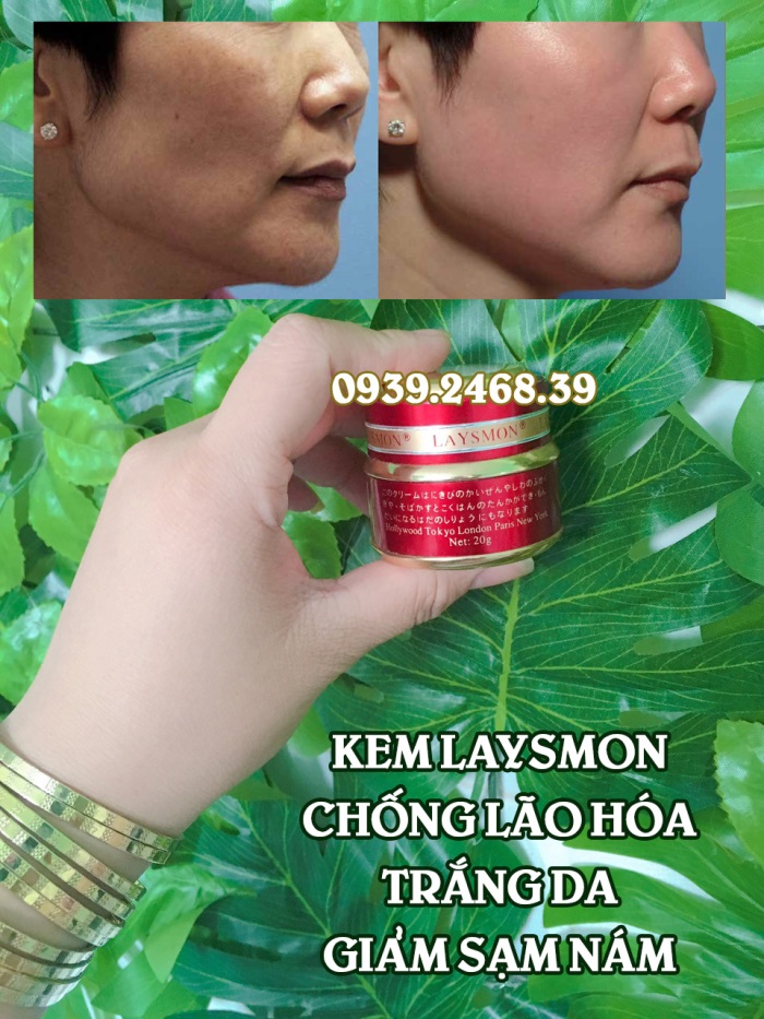 Kem Laysmon DNA chống lão hóa