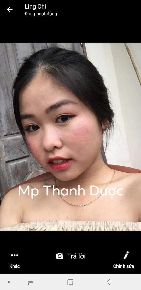 Serum trị mụn Thanh Dược 100% thiên nhiên