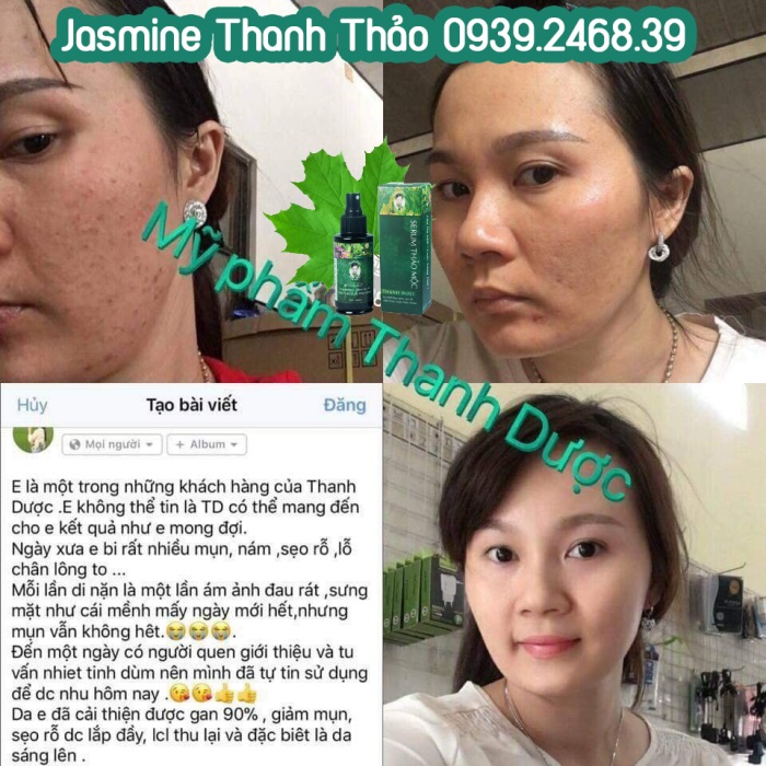 Serum trị mụn Thanh Dược 100% thiên nhiên