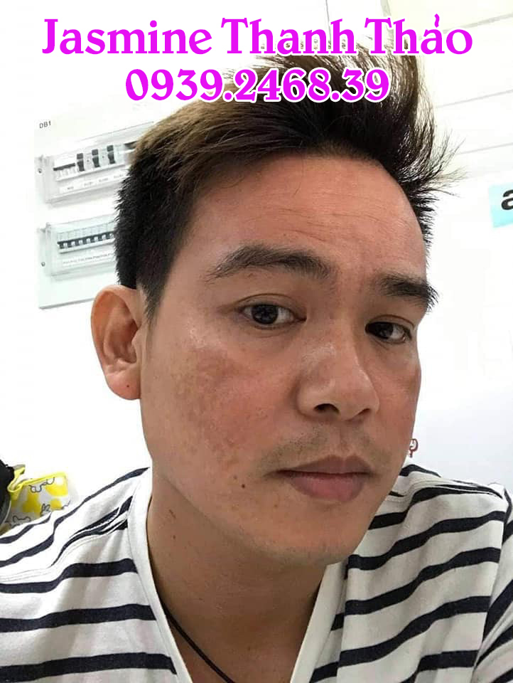 Serum Trị Mụn Thanh Dược
