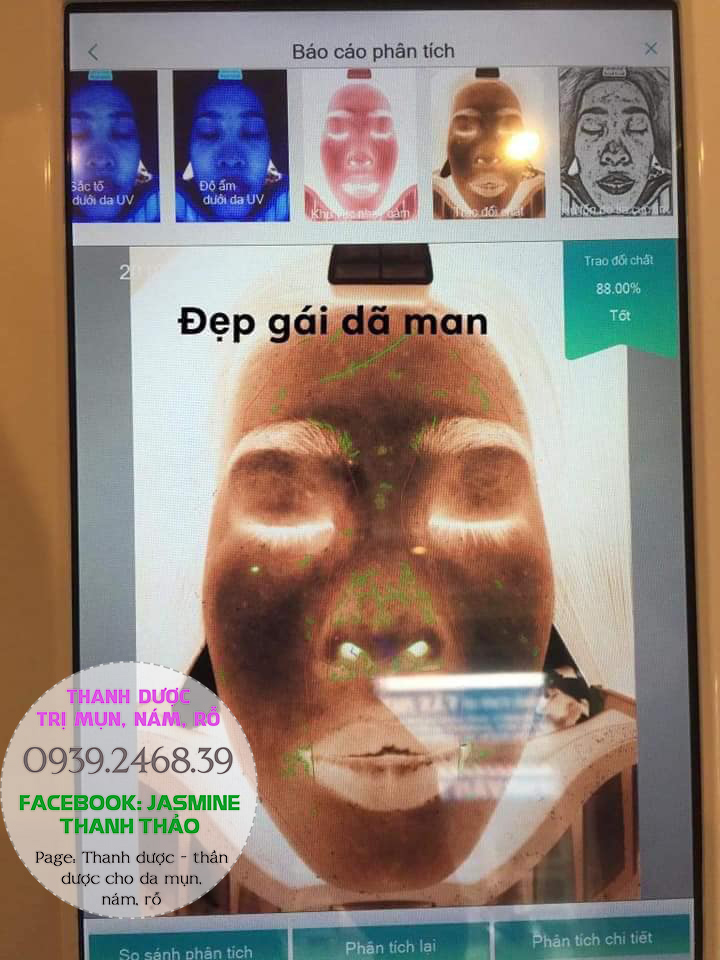 thanh dược trị mụn nám