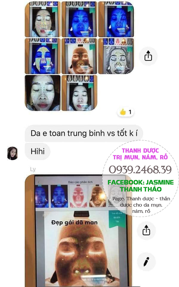 thanh dược trị mụn nám