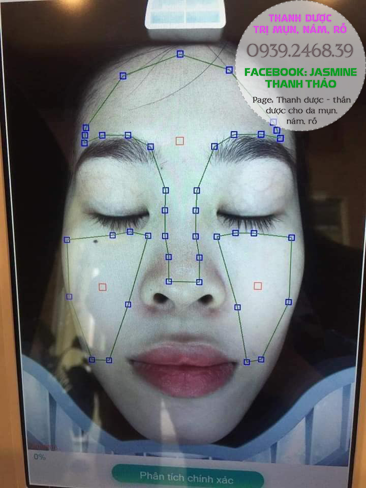 thanh dược trị mụn nám