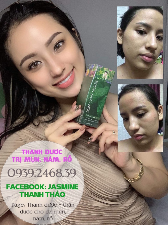 Thanh dược - thần dược cho da mụn, nám, rỗ