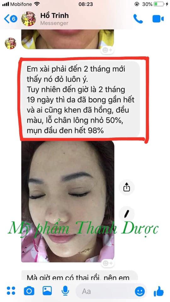 Thanh dược làm đầy sẹo rỗ thế nào?