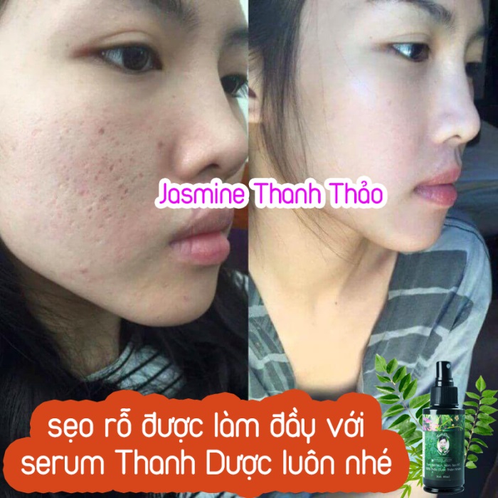 Dùng thanh dược bao lâu thì có kết quả?