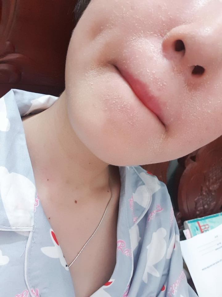 quá trình bong da khi xài thanh dược