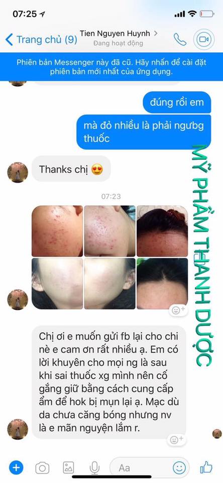 Serum trị mụn Thanh Dược 100% thiên nhiên