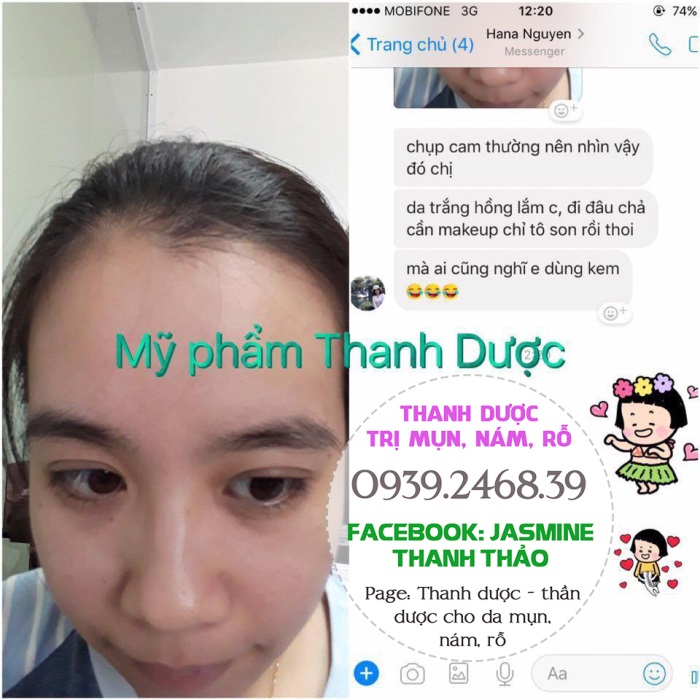 Mỹ phẩm trị mụn thanh dược có an toàn không?