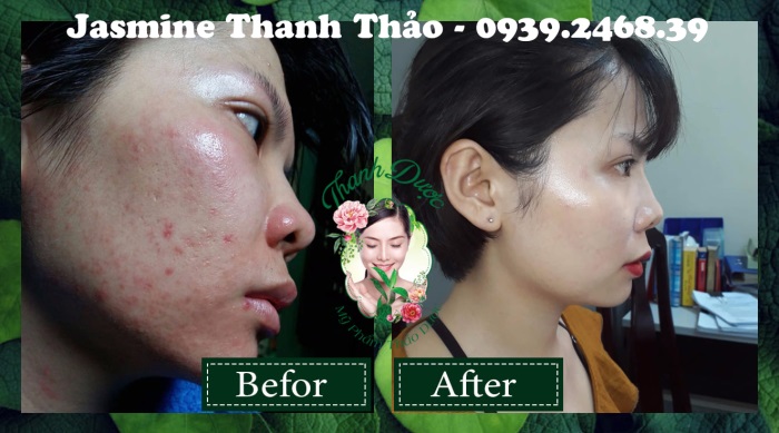 Thanh dược điều trị các vấn đề nào về da?