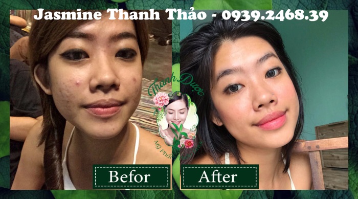 Thanh dược điều trị các vấn đề nào về da?