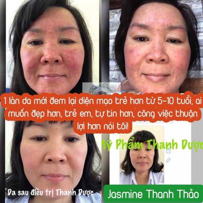 serum đông y phục hồi da thanh dược