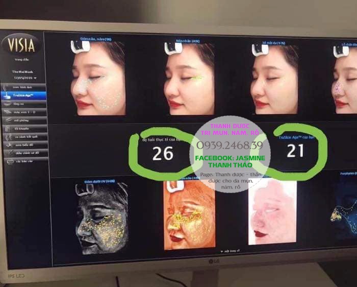 DÙNG THANH DƯỢC CÓ BÀO MÒN DA KHÔNG?