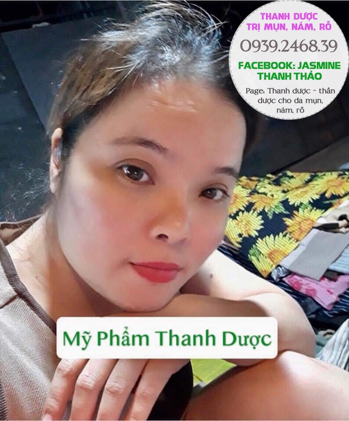 Serum đông y trị mụn Thanh Dược