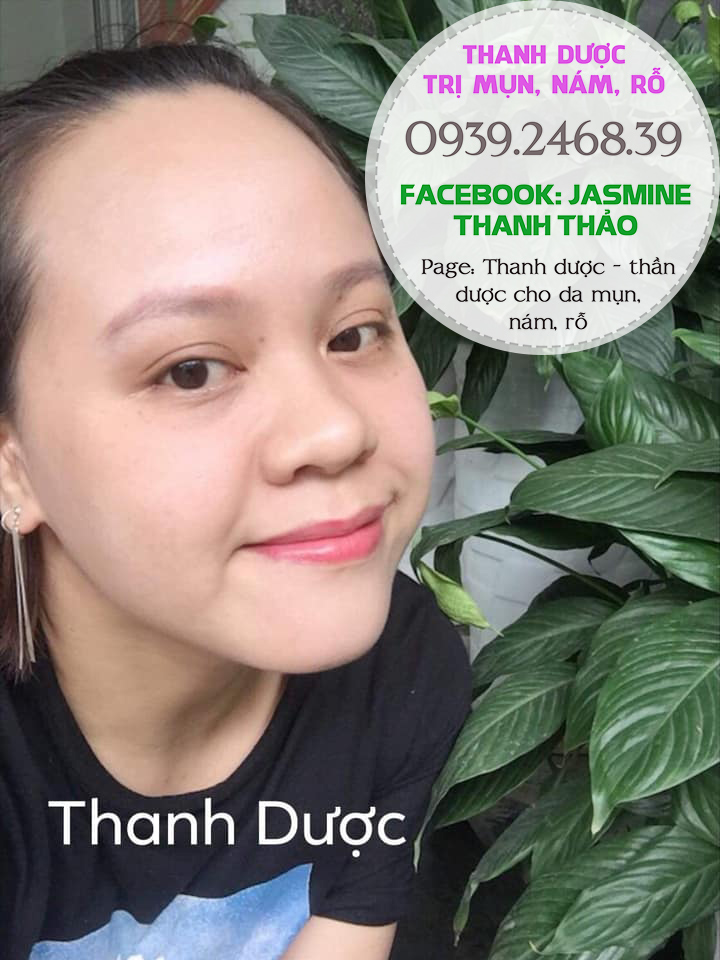 Serum đông y trị mụn Thanh Dược
