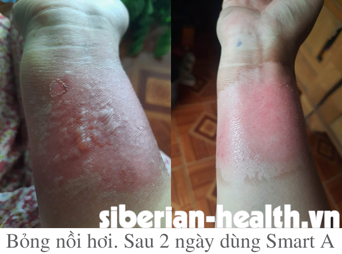 SMART A CHÍNH HÃNG