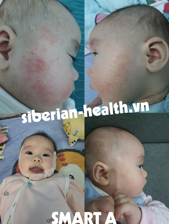 [Hàng chính hãng] SMART A